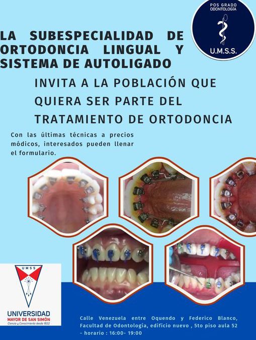 Subespecialidad de ortodoncia lingual autoligado